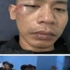 Seorang Pemuda di Tugu Selatan Dikeroyok Sejumlah Orang Tak Dikenal