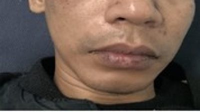 Seorang Pemuda di Tugu Selatan Dikeroyok Sejumlah Orang Tak Dikenal