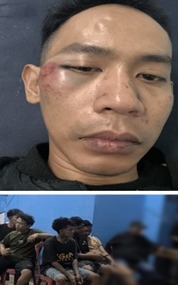 Seorang Pemuda di Tugu Selatan Dikeroyok Sejumlah Orang Tak Dikenal